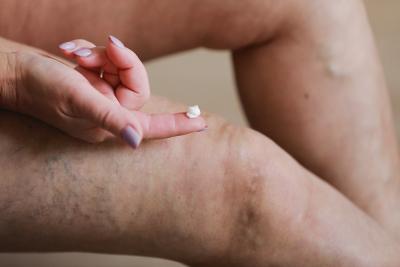 Skin Care Mistakes People with Lymphedema Should Avoid