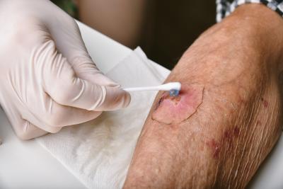 Wound Care or Surgical Dressings: Which Type for Which Application?